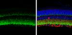 VAMP2 Antibody in Immunohistochemistry (Paraffin) (IHC (P))