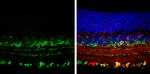 VAChT Antibody in Immunohistochemistry (Paraffin) (IHC (P))