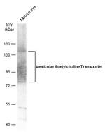 VAChT Antibody in Western Blot (WB)
