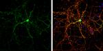 CASK Antibody in Immunocytochemistry (ICC/IF)