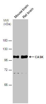 CASK Antibody in Western Blot (WB)