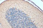 DARPP-32 Antibody in Immunohistochemistry (Paraffin) (IHC (P))