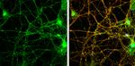 alpha Synuclein Antibody in Immunocytochemistry (ICC/IF)