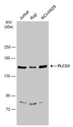 PLCG1 Antibody in Western Blot (WB)