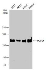 PLCG1 Antibody in Western Blot (WB)