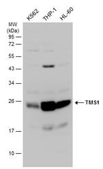 PYCARD Antibody in Western Blot (WB)