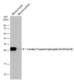 Phospho-Cardiac Troponin I (Ser23, Ser24) Antibody in Western Blot (WB)