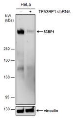 53BP1 Antibody in Western Blot (WB)