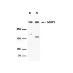 53BP1 Antibody in Western Blot (WB)