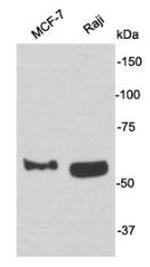 CD62E (E-selectin) Antibody in Western Blot (WB)