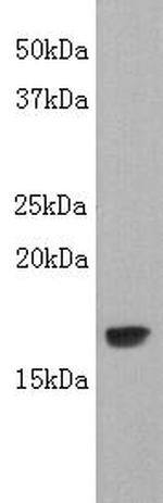 TNF beta Antibody in Western Blot (WB)