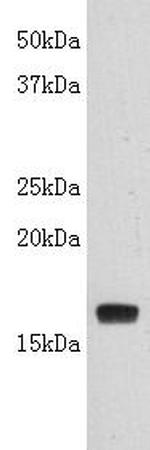 TNF beta Antibody in Western Blot (WB)