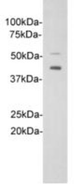 ST2 Antibody in Western Blot (WB)