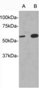 CD213a1 (IL-13Ra1) Antibody in Western Blot (WB)