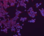 N-cadherin Antibody in Immunocytochemistry (ICC/IF)