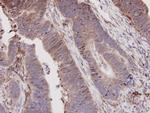 N-cadherin Antibody in Immunohistochemistry (Paraffin) (IHC (P))