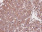 N-cadherin Antibody in Immunohistochemistry (Paraffin) (IHC (P))