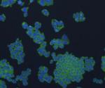 Bax Antibody in Immunocytochemistry (ICC/IF)