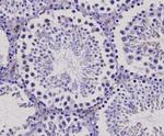 Bax Antibody in Immunohistochemistry (Paraffin) (IHC (P))