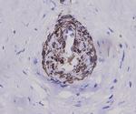 Alpha-Smooth Muscle Actin Antibody in Immunohistochemistry (Paraffin) (IHC (P))