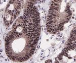 SIRT1 Antibody in Immunohistochemistry (Paraffin) (IHC (P))