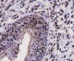 SIRT1 Antibody in Immunohistochemistry (Paraffin) (IHC (P))