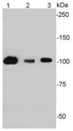 SIRT1 Antibody in Western Blot (WB)