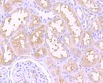 Dysferlin Antibody in Immunohistochemistry (Paraffin) (IHC (P))