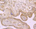 Dysferlin Antibody in Immunohistochemistry (Paraffin) (IHC (P))