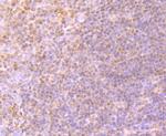 CD61 (Integrin beta 3) Antibody in Immunohistochemistry (Paraffin) (IHC (P))