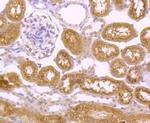 CD61 (Integrin beta 3) Antibody in Immunohistochemistry (Paraffin) (IHC (P))