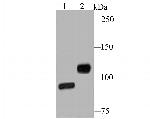 CD61 (Integrin beta 3) Antibody in Western Blot (WB)