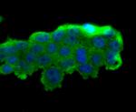 PR3 Antibody in Immunocytochemistry (ICC/IF)