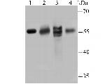 IL17RB Antibody in Western Blot (WB)