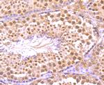 TNFAIP3 Antibody in Immunohistochemistry (Paraffin) (IHC (P))