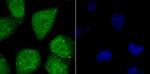 ATF6 Antibody in Immunocytochemistry (ICC/IF)