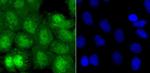 ATF6 Antibody in Immunocytochemistry (ICC/IF)