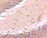 ATF6 Antibody in Immunohistochemistry (Paraffin) (IHC (P))