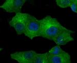 CD71 (Transferrin Receptor) Antibody in Immunocytochemistry (ICC/IF)