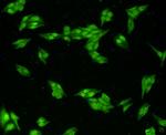 VCP Antibody in Immunocytochemistry (ICC/IF)