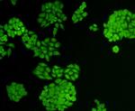 VCP Antibody in Immunocytochemistry (ICC/IF)