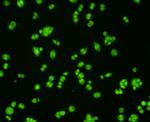 VCP Antibody in Immunocytochemistry (ICC/IF)