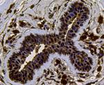 VCP Antibody in Immunohistochemistry (Paraffin) (IHC (P))