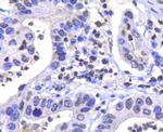 IKK alpha Antibody in Immunohistochemistry (Paraffin) (IHC (P))