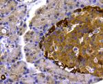 p70 S6 Kinase Antibody in Immunohistochemistry (Paraffin) (IHC (P))