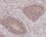 p70 S6 Kinase Antibody in Immunohistochemistry (Paraffin) (IHC (P))