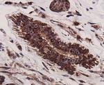 p70 S6 Kinase Antibody in Immunohistochemistry (Paraffin) (IHC (P))