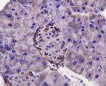 p70 S6 Kinase Antibody in Immunohistochemistry (Paraffin) (IHC (P))