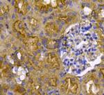 Pan Ras Antibody in Immunohistochemistry (Paraffin) (IHC (P))