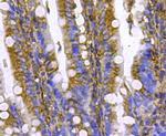 Pan Ras Antibody in Immunohistochemistry (Paraffin) (IHC (P))